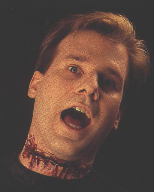 SLIT THROAT APPLIANCE SLIT THROAT APPLIANCE