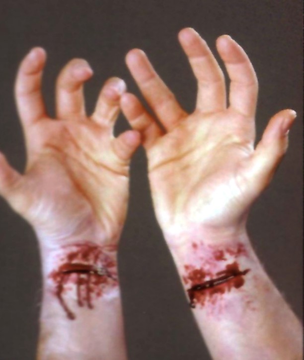 SLASHED WRIST APPLIANCE SLASHED WRIST APPLIANCE